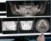 denizli endodonti uzmanı