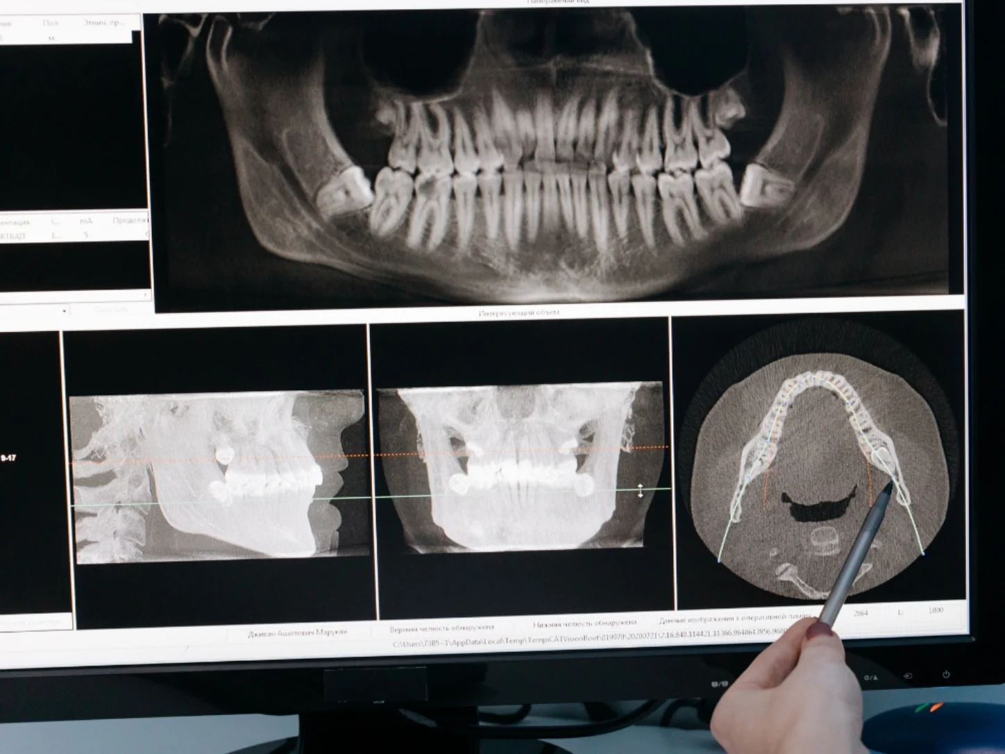 denizli endodonti uzmanı